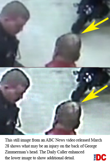 Zimmerman-ABC-video-enhanced-caption.jpg