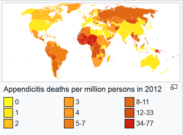 Appendicitis Deaths per million persons.png